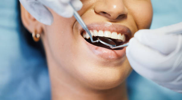 Best Emergency Treatment for Dental Infections or Abscesses in Croom, MD
